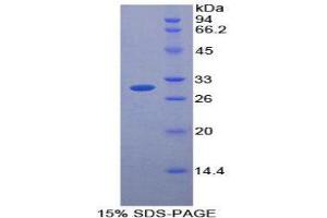 SDS-PAGE (SDS) image for Protease, serine, 12 (Neurotrypsin, Motopsin) (PRSS12) (AA 153-399) protein (His tag) (ABIN2126463)