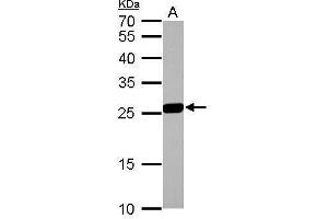 WB Image GSTM1 antibody detects GSTM1 protein by Western blot analysis. (GSTM1 anticorps)