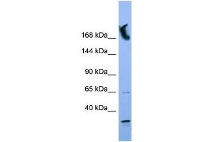 WB Suggested Anti-NUP155 Antibody Titration: 0. (NUP155 anticorps  (N-Term))
