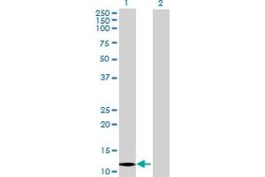 Lane 1: ABCC6 transfected lysate ( 11 KDa) Lane 2: Non-transfected lysate.