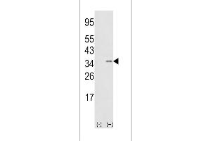 Western blot analysis of SNAI1 (arrow) using rabbit polyclonal hSNAI1-D24 (ABIN388809 and ABIN2850429).