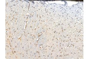 ABIN7094842 and ABIN7098893 at 1/100 staining Rat brain tissue by IHC-P.