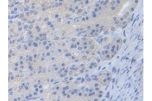 Detection of PFKM in Rat Stomach Tissue using Polyclonal Antibody to Phosphofructokinase, Muscle (PFKM)