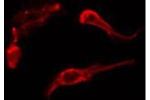ABIN6274208 staining HepG2 cells by IF/ICC. (AKAP5 anticorps  (N-Term))