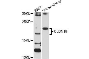 Western blot analysis of extracts of various cell lines, using CLDN19 Antibody (ABIN1871893) at 1:1000 dilution. (Claudin 19 anticorps)