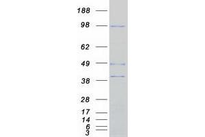 Validation with Western Blot