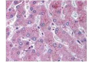 anti-NOTCH 2 antibody was diluted 1:500 to detect NOTCH 2 in human liver tissue. (NOTCH2 anticorps  (N-Term))