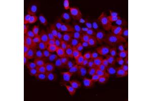 IF analysis of Aldolase/ALDOB using anti-Aldolase/ALDOB antibody (ABIN7602563). (ALDOB anticorps  (AA 85-364))