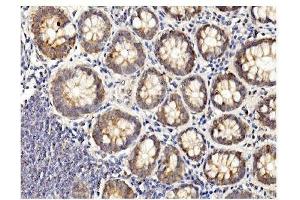 IHC analysis of BubR1/BUB1B using anti-BubR1/BUB1B antibody (ABIN7600961). (BUB1B anticorps  (AA 26-448))