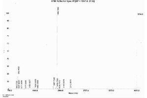 Image no. 1 for Brain Natriuretic Peptide (BNP) protein (Ovalbumin) (ABIN1880241) (BNP Protein (Ovalbumin))