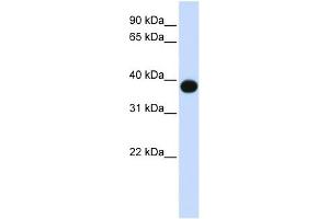 DEGS1 antibody used at 1 ug/ml to detect target protein. (DEGS1 anticorps)