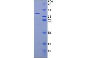 SDS-PAGE analysis of Human C3a Protein. (C3a Protéine)