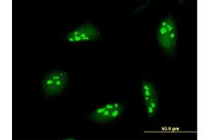 Immunofluorescence of purified MaxPab antibody to NOL7 on HeLa cell. (NOL7 anticorps  (AA 1-257))