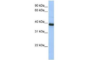 SPO11 antibody used at 1 ug/ml to detect target protein. (SPO11 anticorps)