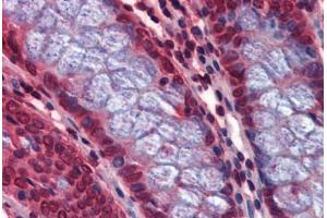 Human Colon: Formalin-Fixed, Paraffin-Embedded (FFPE) (Calcyphosine 2 anticorps  (Internal Region))