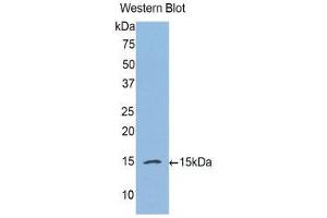 Western Blotting (WB) image for anti-Complement Factor B (CFB) (AA 270-388) antibody (ABIN1175357) (Complement Factor B anticorps  (AA 270-388))