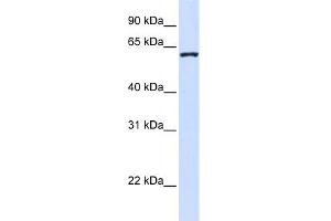WB Suggested Anti-WDR40A Antibody Titration:  0. (DCAF12 anticorps  (Middle Region))