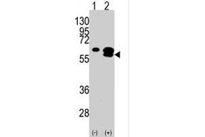 Western blot analysis of CAMK1G (arrow) using rabbit polyclonal CAMK1G polyclonal antibody . (CAMK1G anticorps  (C-Term))