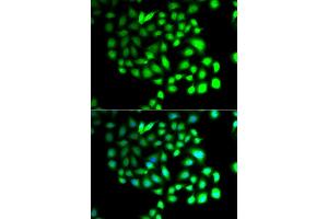 Immunofluorescence analysis of A549 cell using TCEAL8 antibody.