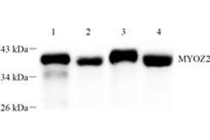 Western blot analysis of Myoz2 (ABIN7074744) at dilution of 1: 1000,Lane 1: Mouse heart muscle tissue lysate,Lane 2: Mouse skeletal muscle tissue lysate,Lane 3: Rat heart muscle tissue lysate,Lane 4: Rat skeletal muscle tissue lysate (MYOZ2 anticorps)