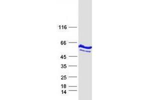 Validation with Western Blot