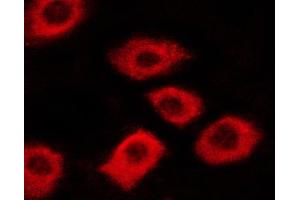 ABIN6267340 staining A431 cells by ICC/IF. (c-MET anticorps  (pTyr1003))