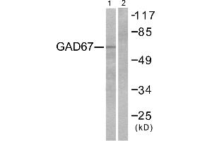 Western blot analysis of extracts from LOVO cells, using GAD67 antibody. (GAD anticorps)