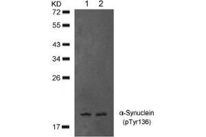 Image no. 1 for anti-Synuclein, alpha (SNCA) (pTyr136) antibody (ABIN401577) (SNCA anticorps  (pTyr136))