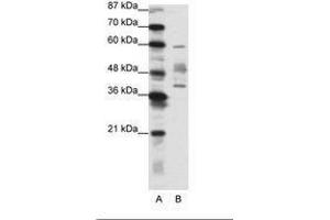 Image no. 1 for anti-Aprataxin (APTX) (N-Term) antibody (ABIN202287) (Aprataxin anticorps  (N-Term))