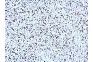 IHC-P Image Immunohistochemical analysis of paraffin-embedded C2C12 xenograft, using POM121, antibody at 1:500 dilution.