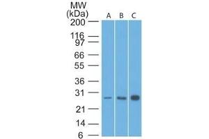 Western Blot Analysis of Bcl-2 in human A) HeLa, B) A549 and C) MCF7 lysate using Bcl-2 Mouse Monoclonal Antibody (8C8). (Bcl-2 anticorps  (AA 41-54))