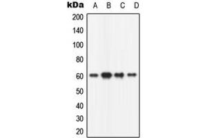 Western blot analysis of CaMK2 beta expression in HeLa (A), mouse brain (B), rat brain (C), PC12 (D) whole cell lysates.