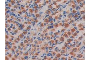 Detection of CD244 in Rat Stomach Tissue using Polyclonal Antibody to Cluster of Differentiation 244 (CD244)