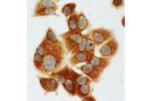 Anti-MEK1 antibody, ICC ICC: MCF-7 Cell