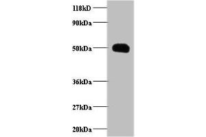 Western blot All lanes: CCL2 antibody at 2 μg/mL + EC109 whole cell lysate Secondary Goat polyclonal to rabbit IgG at 1/15000 dilution Predicted band size: 12 kDa Observed band size: 50 kDa