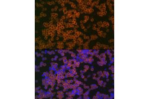 anti-CD38 (AA 46-300) antibody