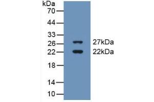 Western blot analysis of recombinant Human CIRBP. (CIRBP anticorps  (AA 1-172))