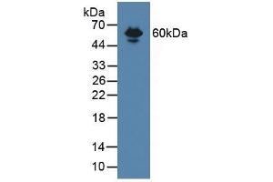 Detection of ENG in Mouse Serum using Polyclonal Antibody to Endoglin (ENG) (Endoglin anticorps  (AA 27-137))