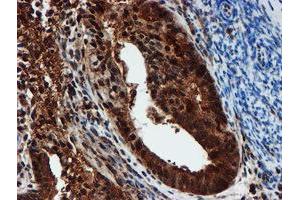 Image no. 5 for anti-Proteasome Subunit alpha 6 (PSMA6) antibody (ABIN1500464)