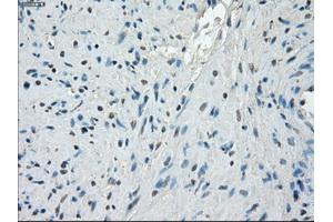 Immunohistochemistry (IHC) image for anti-Protein Phosphatase 5, Catalytic Subunit (PPP5C) antibody (ABIN1500393)