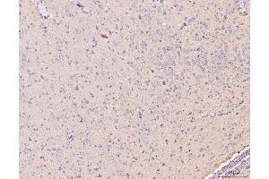 IHC analysis of MT-CO2 using anti-MT-CO2 antibody (ABIN7599081). (COX2 anticorps  (AA 1-205))