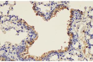 Immunohistochemistry of paraffin-embedded Mouse lung using PLAUR Ployclonal Antibody at dilution of 1:200. (PLAUR anticorps)