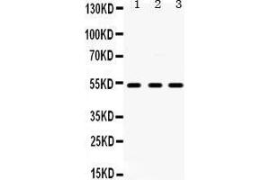 Western Blotting (WB) image for anti-5-Hydroxytryptamine (serotonin) Receptor 2A (HTR2A) (AA 400-431), (C-Term) antibody (ABIN3042729) (HTR2A anticorps  (C-Term))