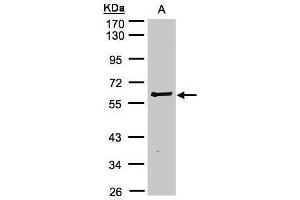 WB Image Sample(30 μg of whole cell lysate) A:Raji, 10% SDS PAGE antibody diluted at 1:2000 (RIPK2 anticorps)