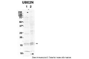 Sample Type: 1. (UBE2N anticorps  (Middle Region))