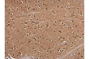 IHC-P Image RSK2 antibody detects RSK2 protein at cytosol and nucleus on rat middle brain by immunohistochemical analysis.