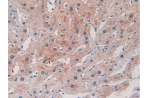 IHC-P analysis of Human Liver Tissue, with DAB staining. (BACE2 anticorps  (AA 230-396))