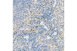 Immunohistochemistry analysis of paraffin-embedded mouse speen using,NLRP1 (ABIN7074850) at dilution of 1: 1000 (NLRP1 anticorps)