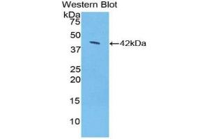Detection of Recombinant SDC1, Rat using Polyclonal Antibody to Syndecan 1 (SDC1) (Syndecan 1 anticorps  (AA 58-313))