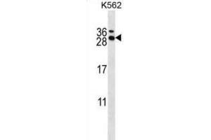 Western Blotting (WB) image for anti-RCAN Family Member 3 (RCAN3) antibody (ABIN2997962) (RCAN3 anticorps)